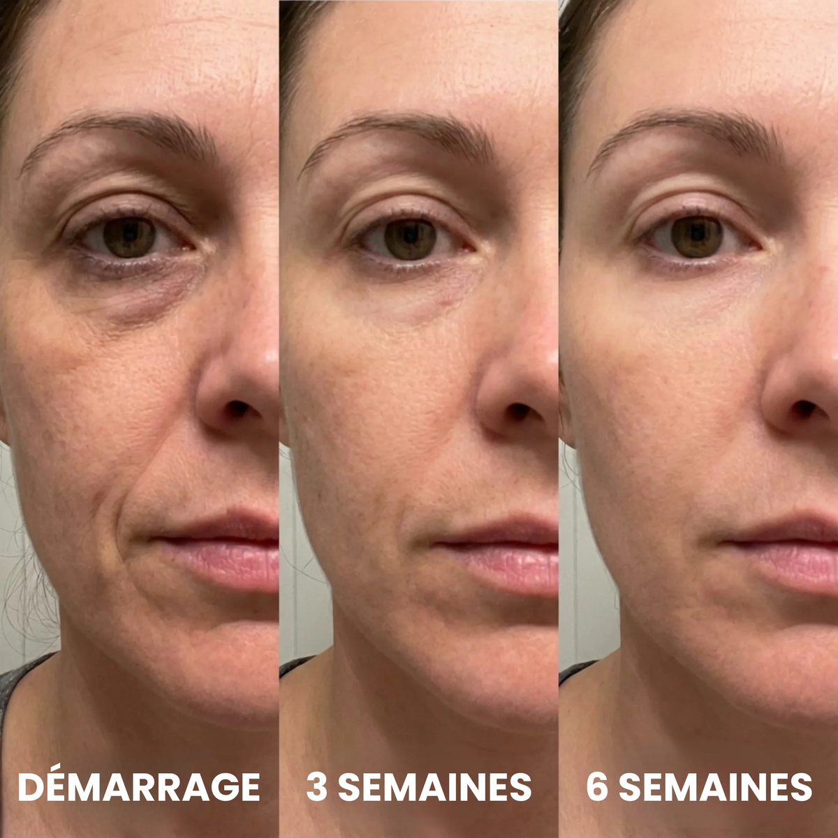 Baume collagène & PDRN — évolution au démarrage, à 3 semaines et à 6 semaines